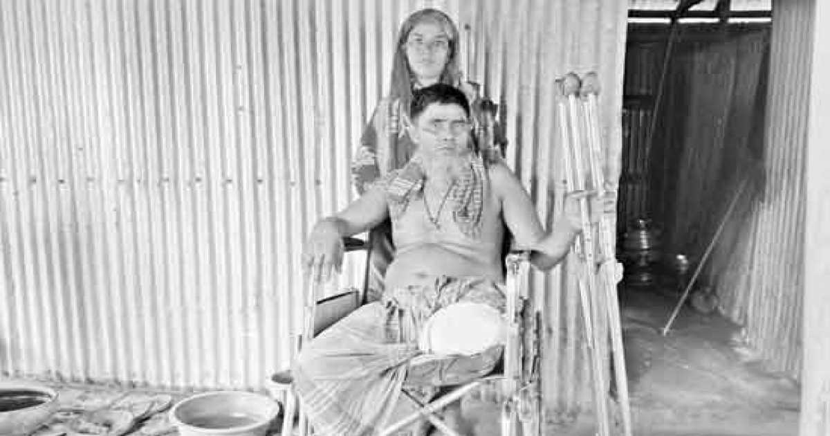 নন্দীগ্রামে পা হারিয়ে মানবেতর জীবন-যাপন রফিকুলের মেলেনি ভাতা