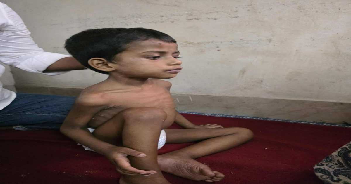 নারায়ণগঞ্জে পিতার ‘অমানবিক আচরণ’, ঘরবন্দি শিশু উদ্ধার